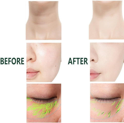 2 In 1 Anti Wrinkle Facial Massager